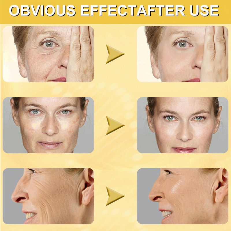 Antirides instantané