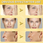 Antirides instantané