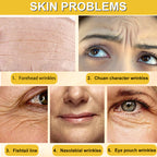 Antirides instantané