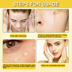 Antirides instantané