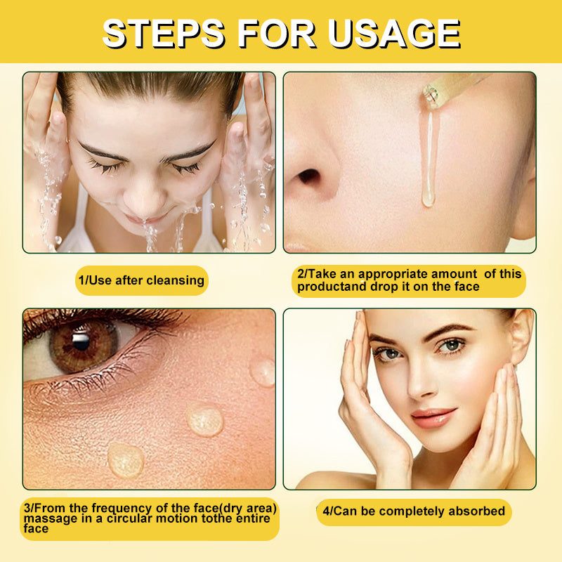 Antirides instantané