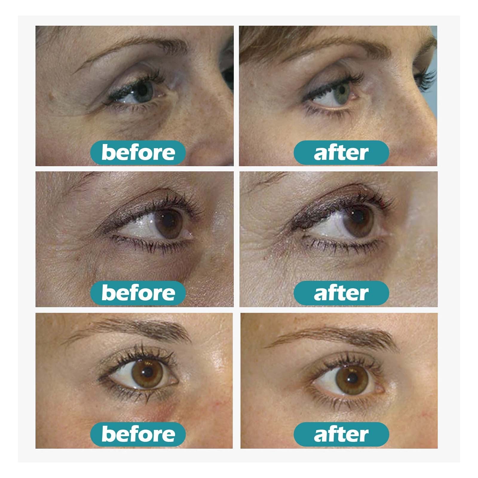 Gel de soin pour les yeux à motif estompé